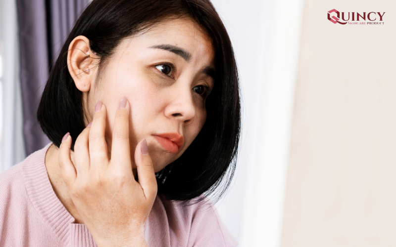 10 Sai Lầm Khiến Da Lão Hóa cần phải tránh 16 Thường xuyên chạm tay lên mặt
