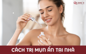 cách trị mụn ẩn tại nhà
