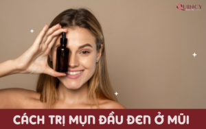 cách trị mụn đầu đen ở mũi