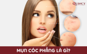 Mụn cóc phẳng là gì?