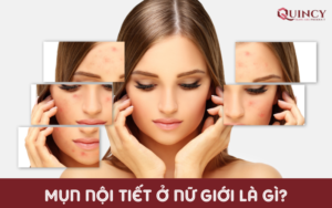 mụn nội tiết ở nữ giới là gì?