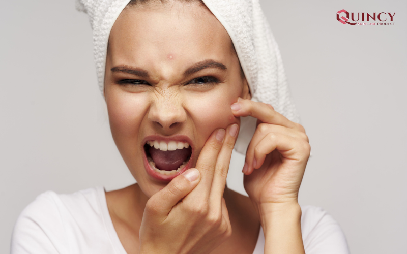 Mụn viêm là gì? Điều trị mụn viêm như thế nào cho hiệu quả? 14 Mụn viêm gây ảnh hưởng như thế nào?