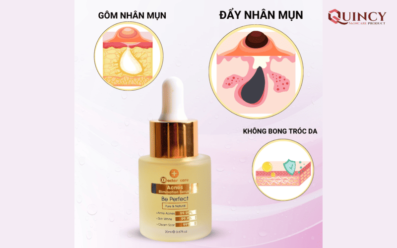 15+ Serum Trị Mụn Ẩn: An Toàn & Hiệu Quả Nhất 2024 76 Sử dụng serum trị mụn ẩn - Phương pháp an toàn, hiệu quả cao