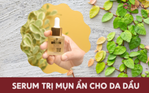 serum trị mụn ẩn cho da dầu