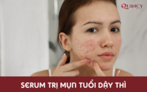 serum trị mụn tuổi dậy thì