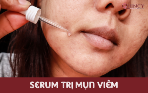 serum trị mụn viêm