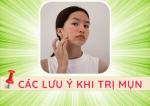 Cac luu y khi tri mun