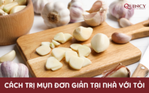 Cách trị mụn đơn giản tại nhà với tỏi
