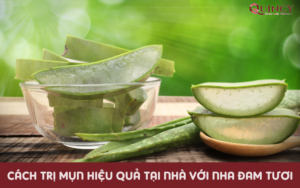 Cách trị mụn hiệu quả tại nhà với nha đam tươi