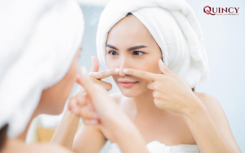 Cách trị mụn tại nhà với dưa leo đơn giản, hiệu nghiệm tại nhà 12 Những thói quen nhỏ góp phần hình thành mụn