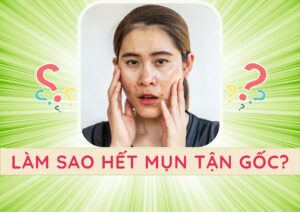 muon het mun tan goc phai lam sao