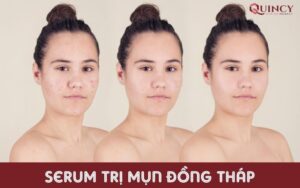 Serum trị mụn Đồng Tháp