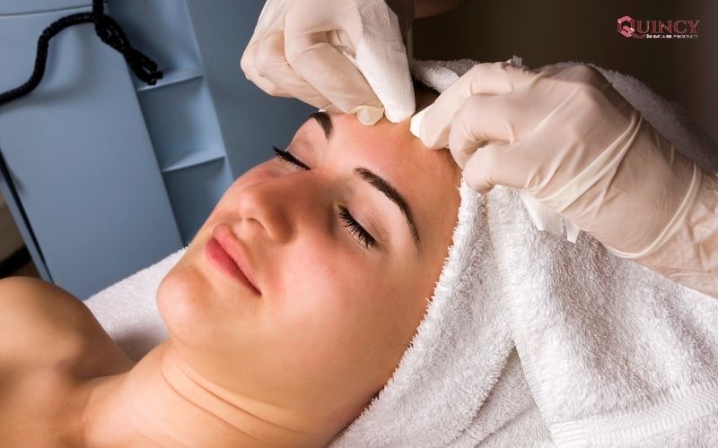 Serum trị mụn Hòa Bình giá rẻ, hiệu quả nhất 12 Các phương pháp trị mụn hiệu quả