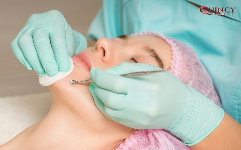 Serum trị mụn Lào Cai hiệu quả, giá re, chất lượng 10 Nguyên tắc cần nhớ để trị mụn thành công