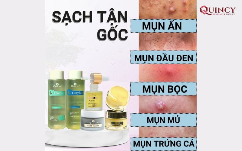 Serum trị mụn TPHCM hiệu quả, giá rẻ, an toàn 44 Phân biệt các loại mụn như thế nào?