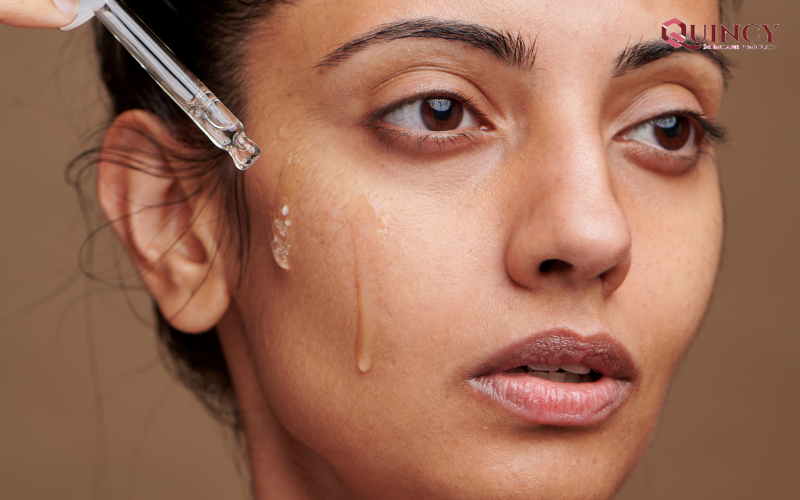 Serum trị mụn TPHCM hiệu quả, giá rẻ, an toàn 46 Các biện pháp hạn chế mọc mụn