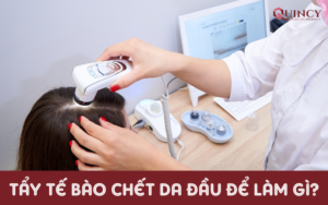 Tẩy tế bào chết da đầu để làm gì?