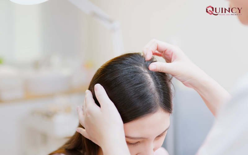 Tẩy tế bào chết da đầu để làm gì? Cách tẩy tế bào chết hiệu nghiệm 21 Những nguyên tắc cần nhớ khi tẩy tế bào chết cho da đầu