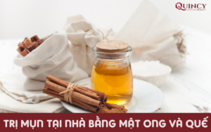 Trị mụn tại nhà bằng mật ong và quế