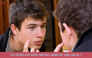 14 tuổi có nên dùng serum trị mụn