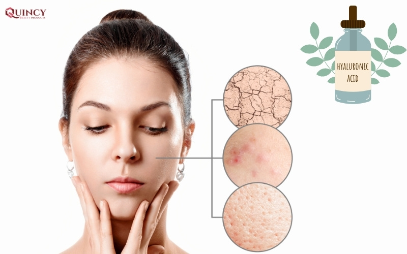 7 hoạt chất chống lão hoá da hiệu quả nhất