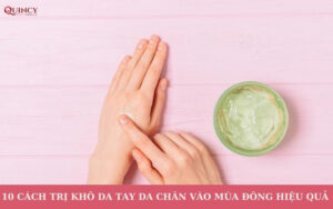 Cách trị khô da tay chân vào mùa đông