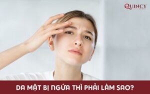 Da mặt bị ngứa thì phải làm sao?