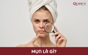 Mụn là gì?