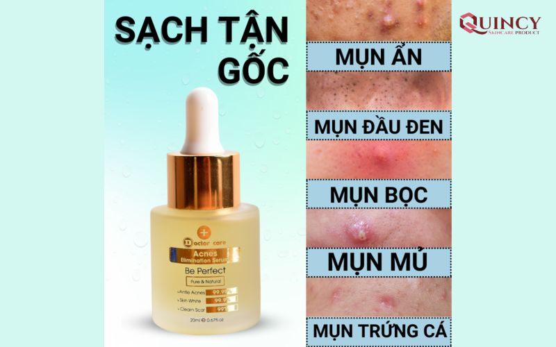 Serum trị mụn tại Huế hiệu quả, sạch mụn 100% 13 Trị sạch tận gốc mụn, ngừa mụn hình thành