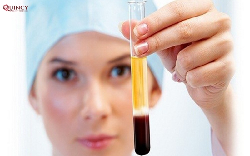 tế bào gốc tự thân là gì