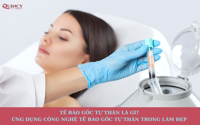 tế bào gốc tự thân là gì