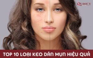 TOP 10 loại keo dán mụn hiệu quả