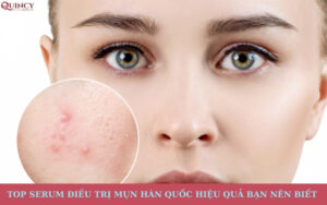 top serum điều trị mụn hàn quốc hiệu quả