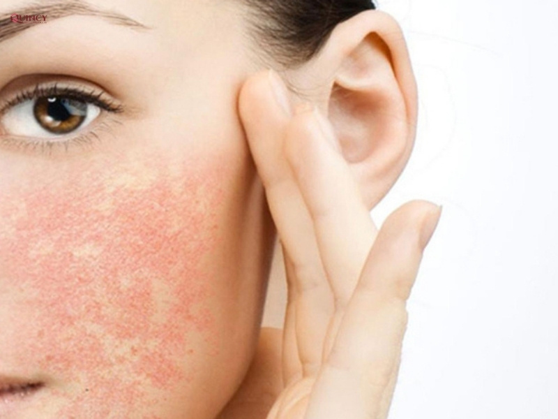 các loại mặt nạ làm đẹp da