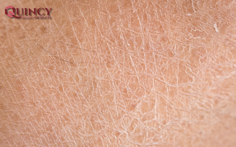 Cấu Trúc của Da và Chức Năng của Da: Sự Kỳ Diệu lớp bao Bọc 10 1. Cấu Trúc của Da và Chức Năng của Da