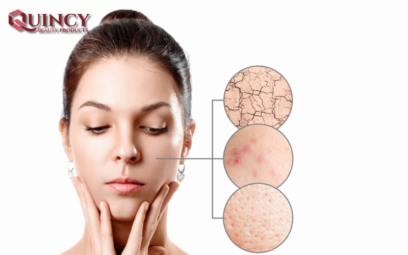 Cấu Trúc của Da và Chức Năng của Da: Sự Kỳ Diệu lớp bao Bọc 8 Sự quan trọng của làn da trong cuộc sống hàng ngày - Cấu Trúc của Da và Chức Năng của Da