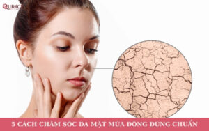 cách chăm sóc da mặt mùa đông