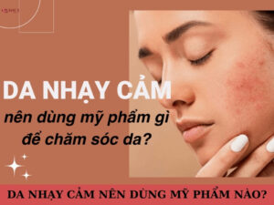 Da nhạy cảm nên dùng mỹ phẩm nào