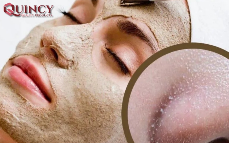 Nguyên nhân gây ra mụn cám - Mụn cám Papules là gì?