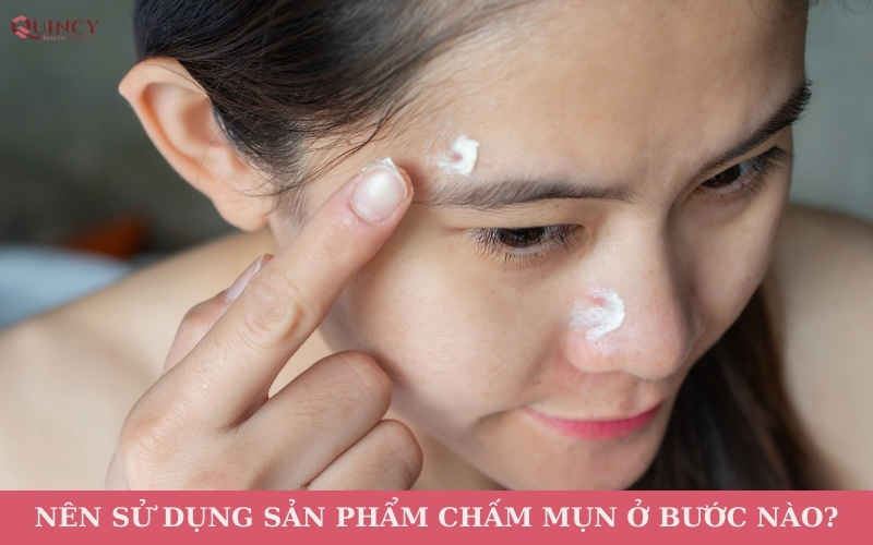 Nên sử dụng sản phẩm chấm mụn ở bước nào