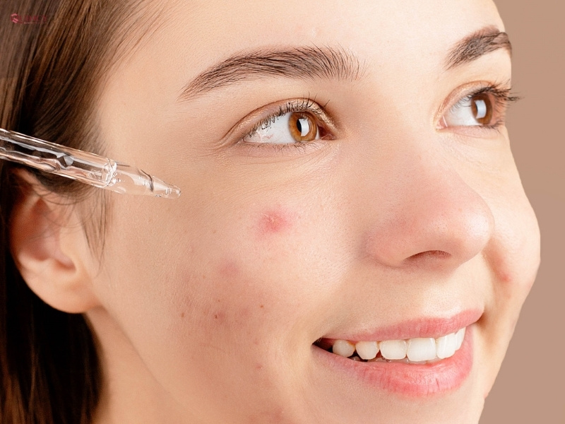 nên sử dụng serum trị mụn bao nhiêu lần 1 ngày