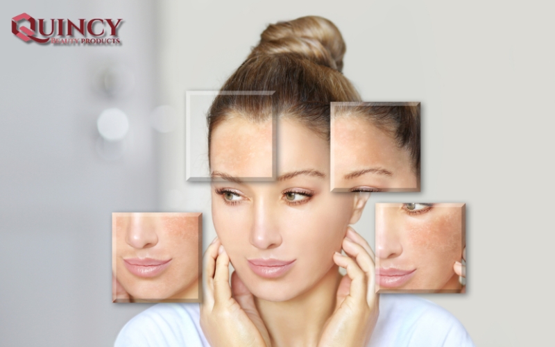 Nhóm Serum Làm Trắng Da: Lời Giải Cho Làn Da Rạng Ngời 19 Lựa chọn Nhóm Serum Làm Trắng Da phù hợp