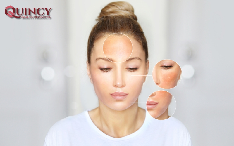Nhóm Serum Làm Trắng Da: Lời Giải Cho Làn Da Rạng Ngời 16 Lợi ích của Nhóm Serum Làm Trắng Da