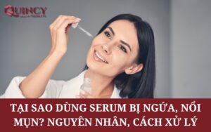 Tại sao dùng Serum bị ngứa, nổi mụn? Nguyên nhân, Cách xử lý
