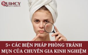 5+ Các Biện pháp phòng tránh mụn của chuyên gia kinh nghiệm