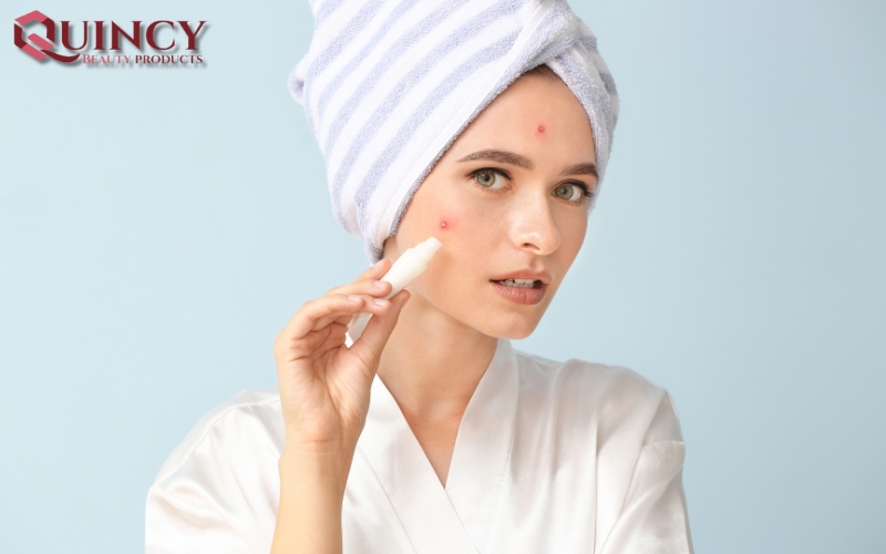 Mụn sưng Cysts là gì? Hiểu rõ Vấn đề - Cách Đối phó chi tiết 13 Mụn sưng Cysts là gì?