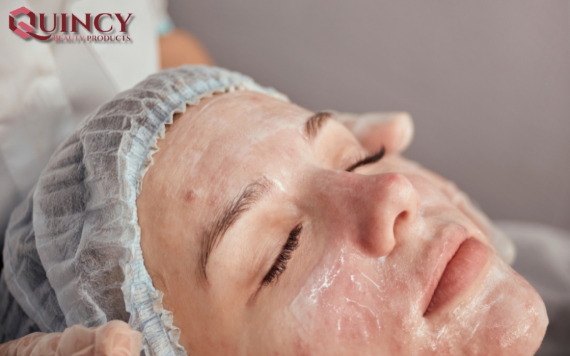 Mụn sưng Cysts là gì?
