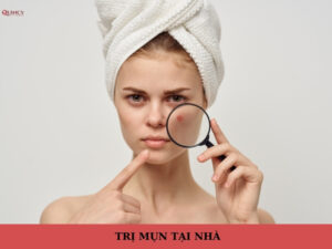 trị mụn tại nhà