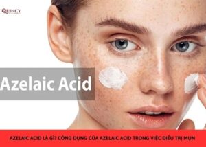 azelaic acid