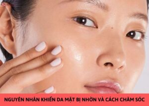 nguyên nhân khiếp da mặt bị nhờn
